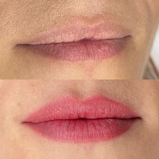 Labios